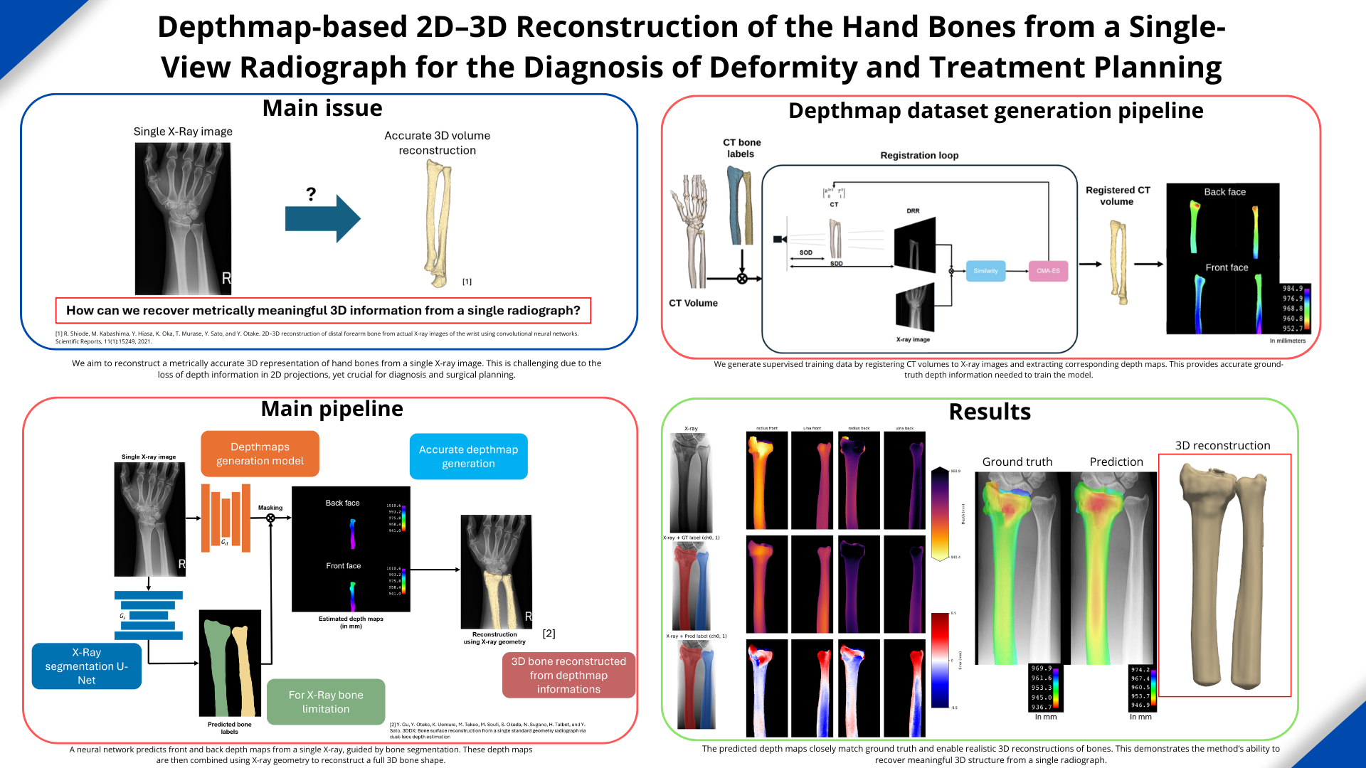 Depthmap-based 2D–3D Reconstruction of the Hand Bones from a Single-View Radiograph for the Diagnosis of Deformity and Treatment Planning