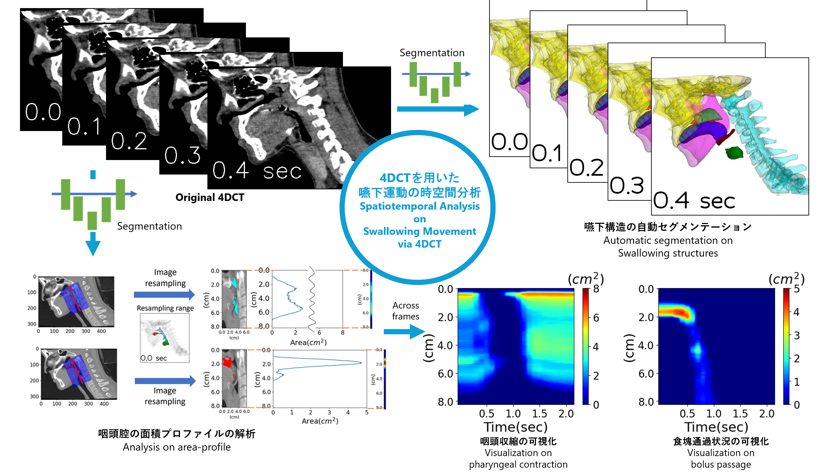 Spatiotemporal Analysis of Swallowing Movement via 4DCT